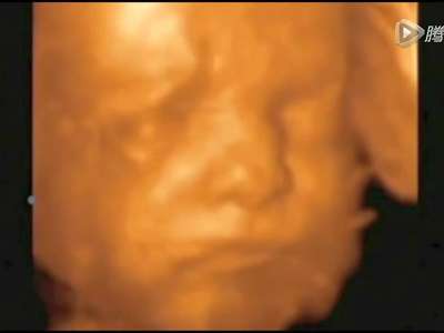 [视频]先进！4D技术实拍腹中胎儿进食打喷嚏 清晰可辨 