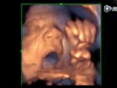 [视频]胎儿在子宫里听到音乐做“鬼脸” 吐长舌头