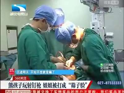 [视频]熊孩子家中玩射钉枪 姐姐被打成“筛子脸”