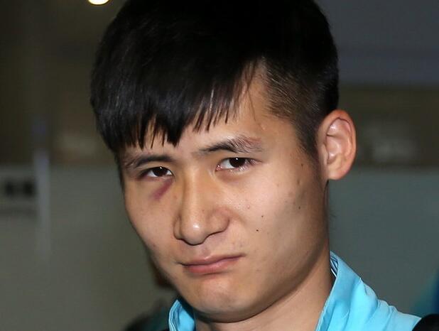 周云确诊面部骨折 恐缺周日足协杯决赛