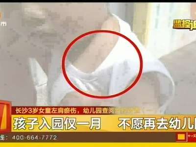 长沙3岁女童左肩瘀伤 幼儿园查阅监控调查