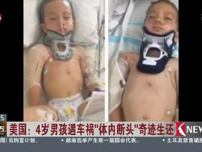 [视频]美国：4岁男孩遇车祸“体内断头”奇迹生还