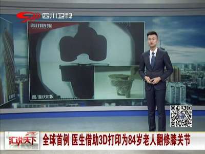 [视频]全球首例 医生借助3D打印为84岁老人翻修膝关节