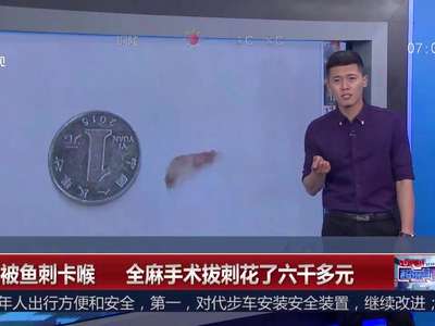 [视频]吃鱼被鱼刺卡喉 全麻手术拔刺花了六千多元
