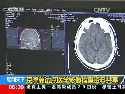 [视频]京津冀试点医学影像检查资料共享